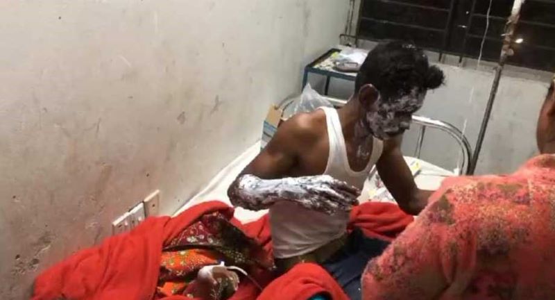 মাদারীপুরে গ্যাস সিলিন্ডার বিস্ফোরণে একই পরিবারের তিন জন দগ্ধ